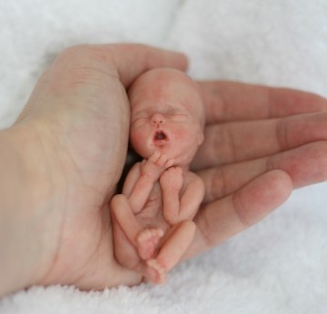 Picture Suggesting 12 Weeks Gestation Baby Legal to Kill in All 50 States