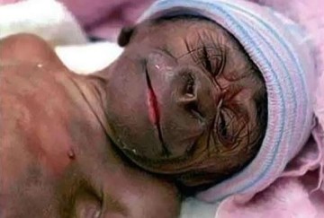 Picture Suggesting Scientists Cloned a Half Human, Half Gorilla Hybrid Called Hurilla