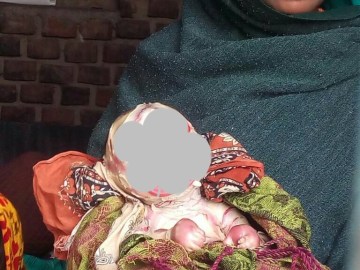 Image about Alien, Demon Baby Born from Woman Womb in India