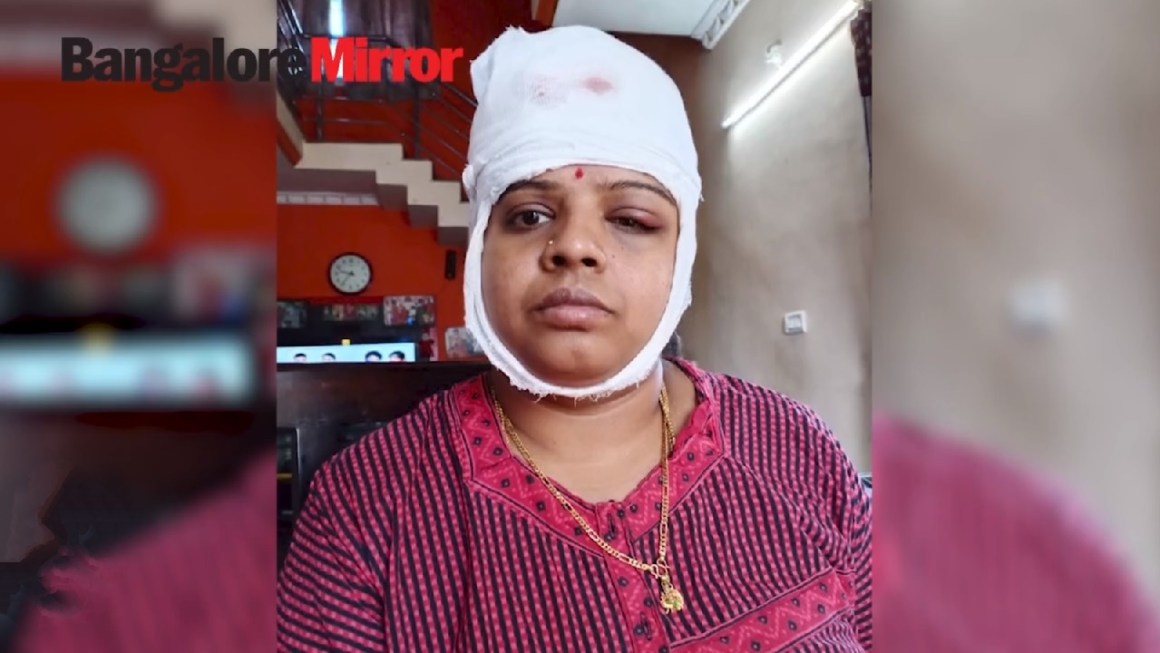 Image of Hotelier Sunita injured in the accident